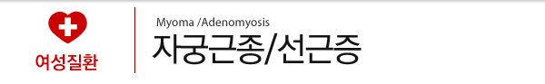 자궁근종/선긍증