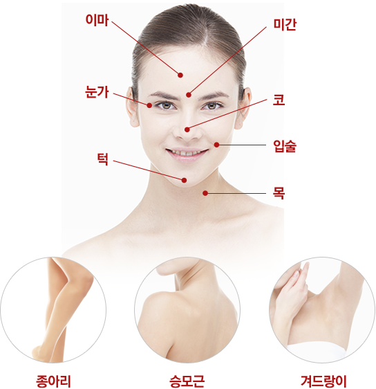 보톡스 시술 가능 부위